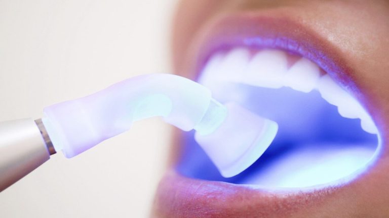 zoom teeth whitening aftercare